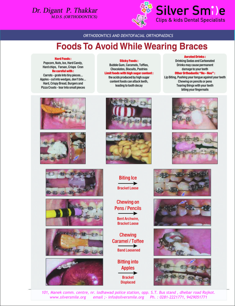 How to Take Care of Your Braces Silver Smile Dental Specialists Rajkot SILVER SMILE